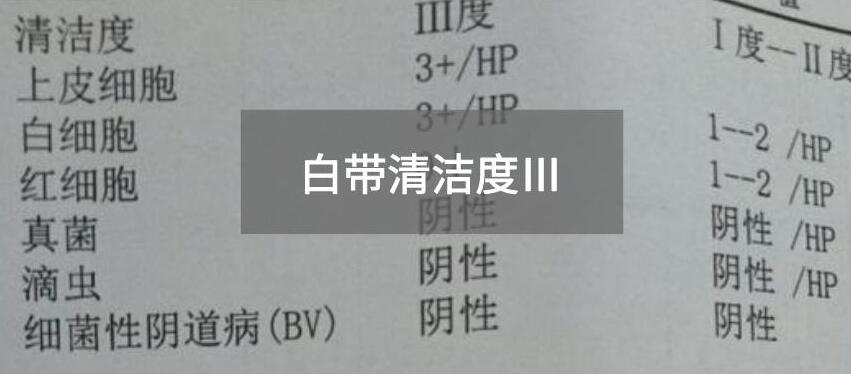 今天快讯！全自动白带午夜小视频网站生产厂家午夜福利网址小视频为您官方解释白带清洁度3的意思