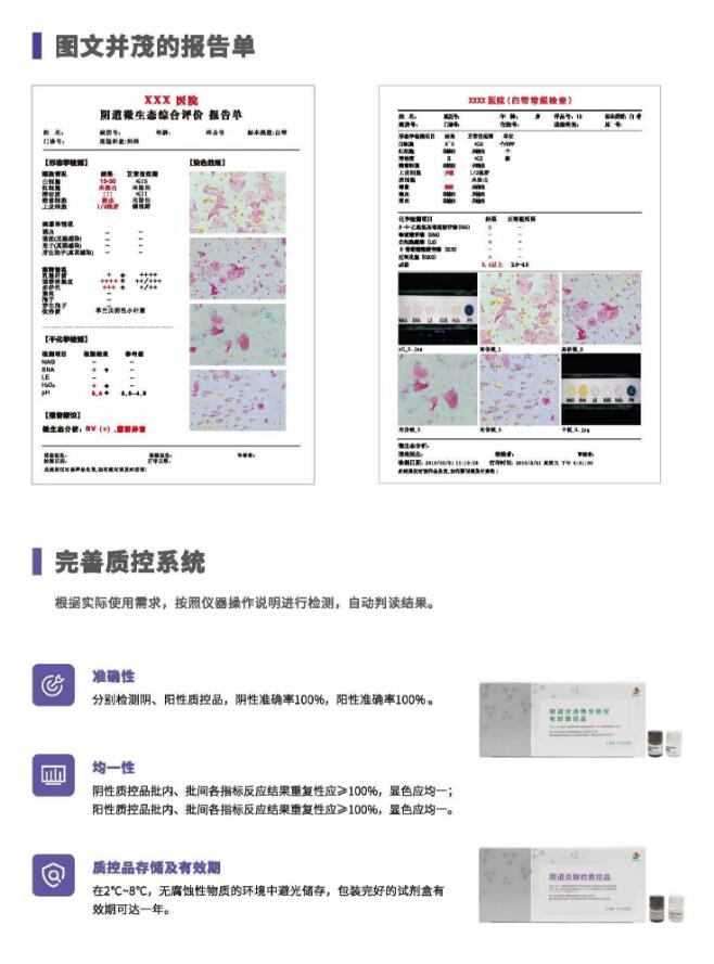 阴道分泌物午夜小视频网站V800报告单